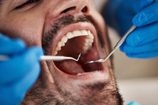 Best Emergency Orthodontic Services in Pine Nyon, CA